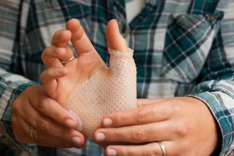 ergotherapiekennemerland-handtherapie Ergotherapie Kennemerland - Handtherapie